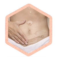 Idrocolonterapia
